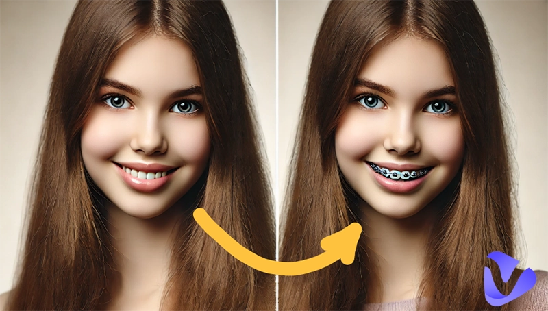 Virtual Braces Try-On: See What I Look Like with or Without Braces