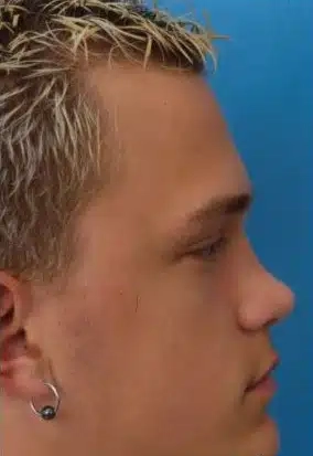 What Is My Nose Shape Picture Test Shape Example 1