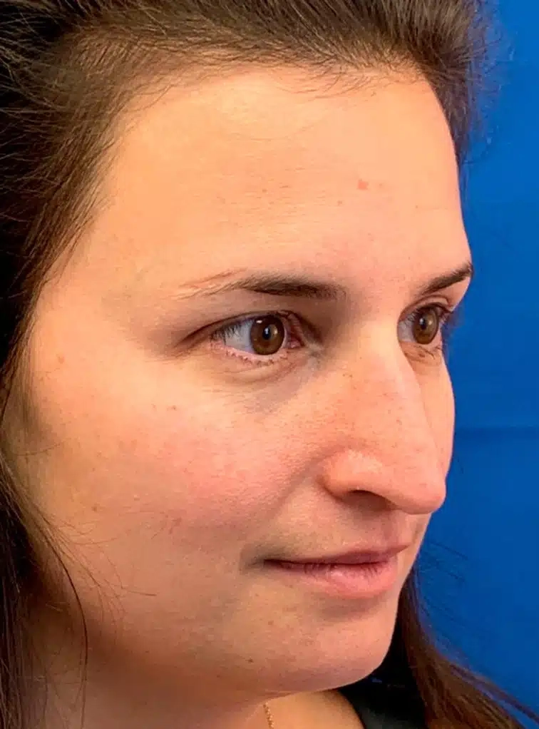 What Is My Nose Shape Picture Test Shape Example 5